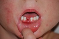 first tooth first tooth